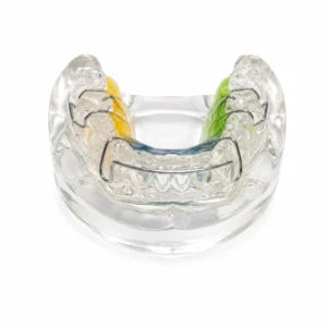 Clear dental retainer with colored sections (yellow, blue, green) on a white background; an orthodontic appliance for teeth alignment.
