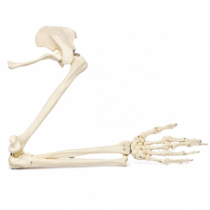 Anatomical model of a leg skeleton with hip and foot, showing metal screws at several joints for orthopedic demonstration.